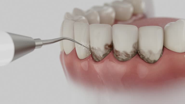 Reliable Dental Implants contractor in Dermott, AR by Smile Center Dentistry